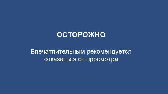 Картинка слабонервным не смотреть